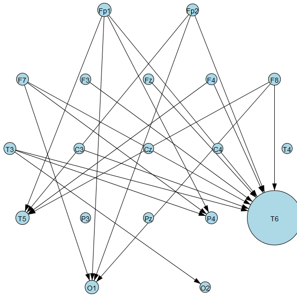 Filtered network of brain activity